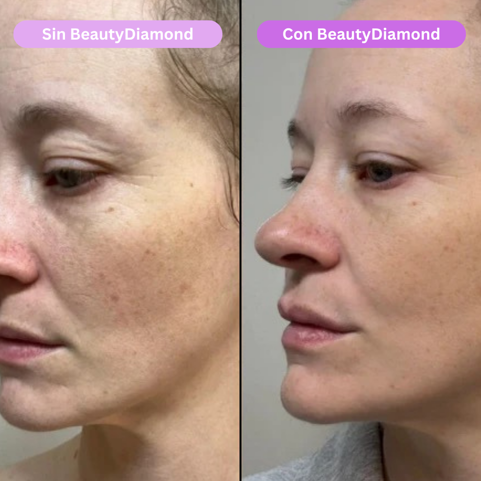 BeautyDiamond: Masajeador Facial LED